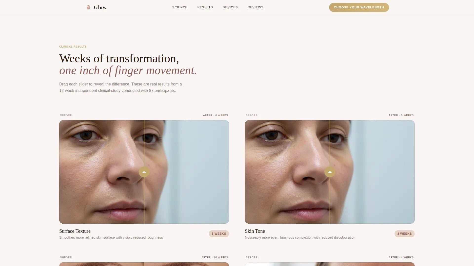Radiant Skincare At-Home Laser Device Landing Page