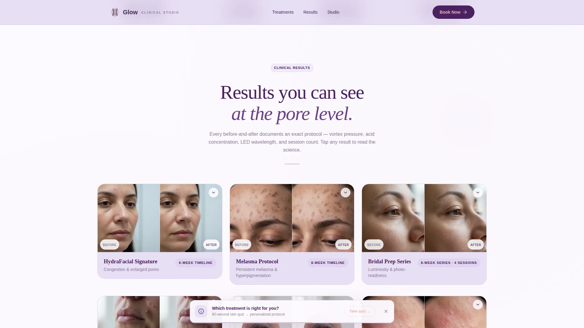 Skincare Landing Page Template for Hydrafacial Studios