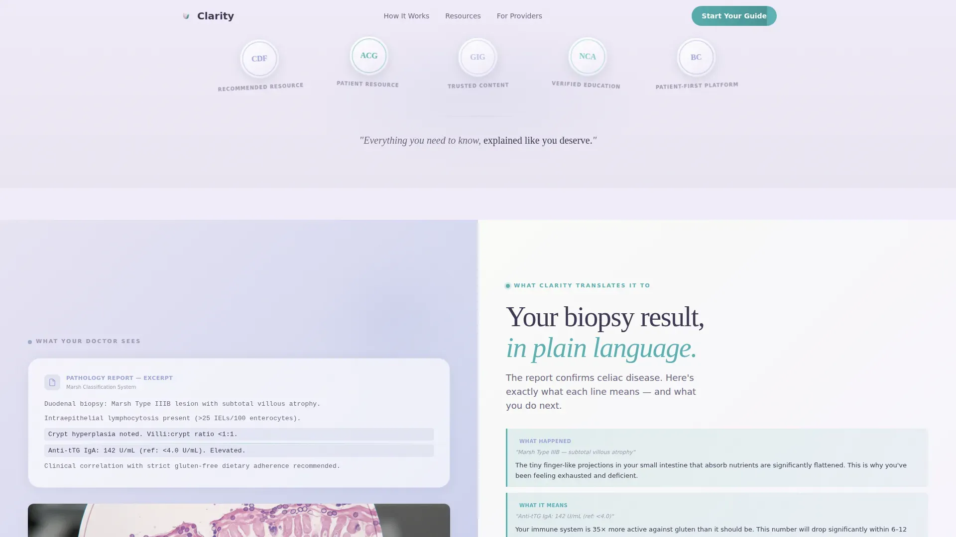 Celiac Disease Care Education Website Template