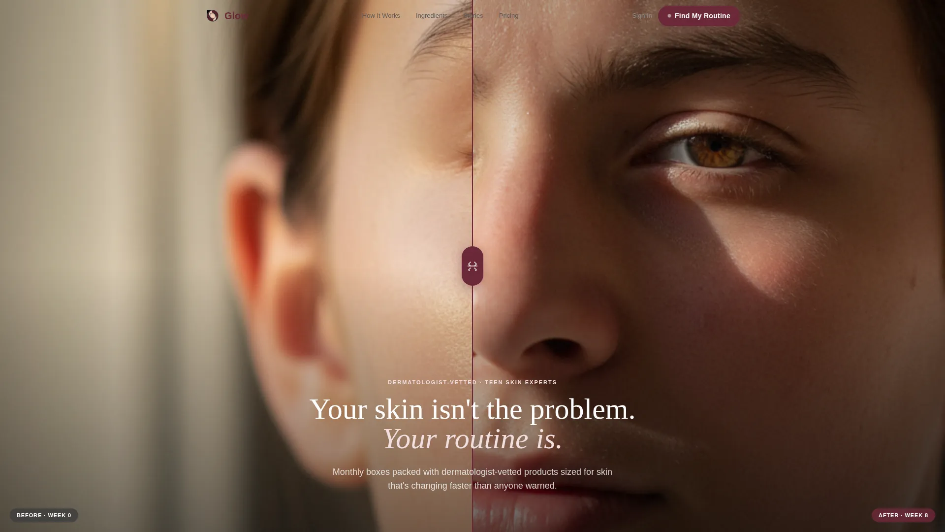 Radiant Teenskin | Free Website Template | Rocket