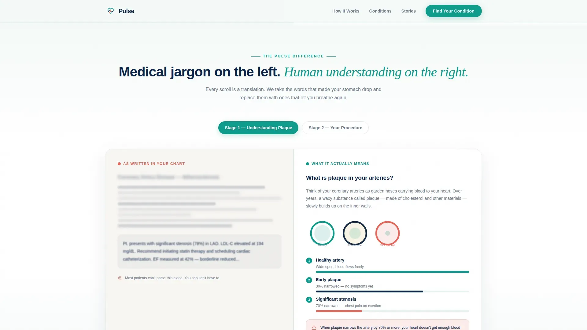 Heart Disease Patient Education Landing Page Template