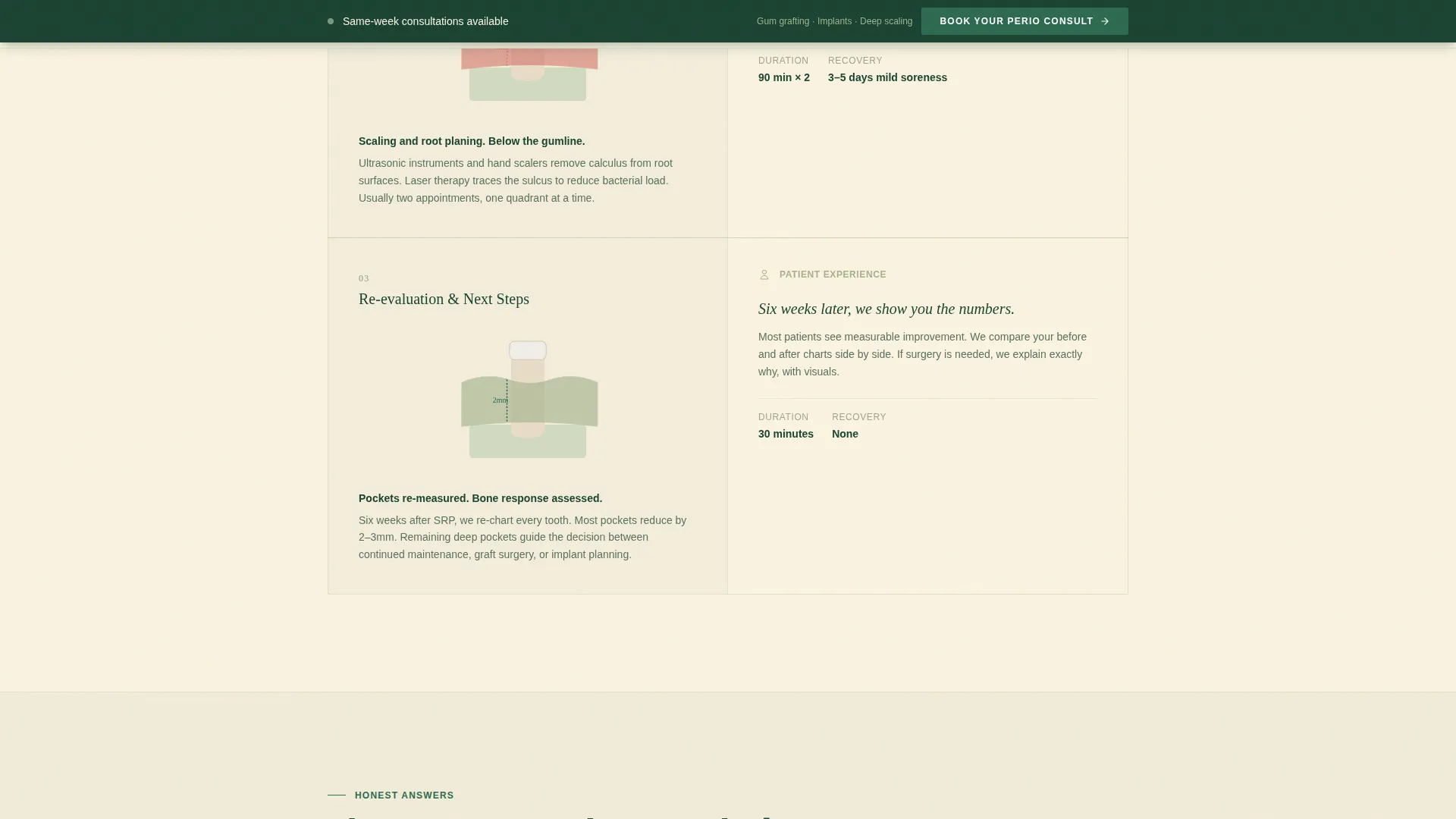 Periodontist Appointment Booking Landing Page
