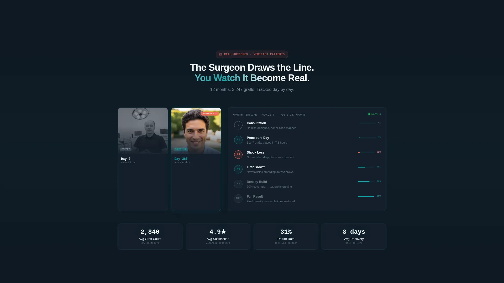 Hair Transplant Booking Landing Page Template